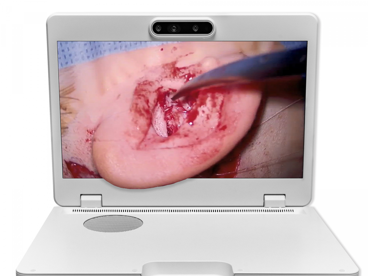 达擎之＂Heads-up 3D显微手术显示系统＂，整合4K裸眼3D显示及眼球追踪系统，具备快速追踪人眼移动位置功能，减轻医师长时间维持固定姿势的负担，让医师能有更宽广清晰的3D立体视野及更舒适的姿势来执行手术。